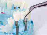 梦见好多乌龟满地爬(梦见好多乌龟满地爬很凶)