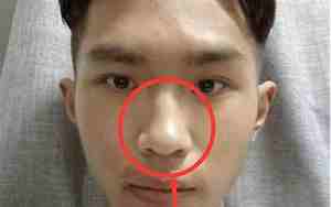 面相学男人鼻子